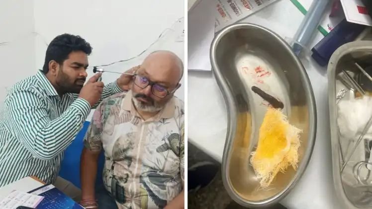 गदेरे का पानी बना खतरा: बुजुर्ग और मासूम की नाक से निकाली जिंदा जोंक